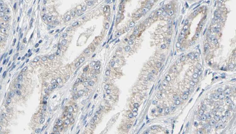 DNM1 / Dynamin Antibody