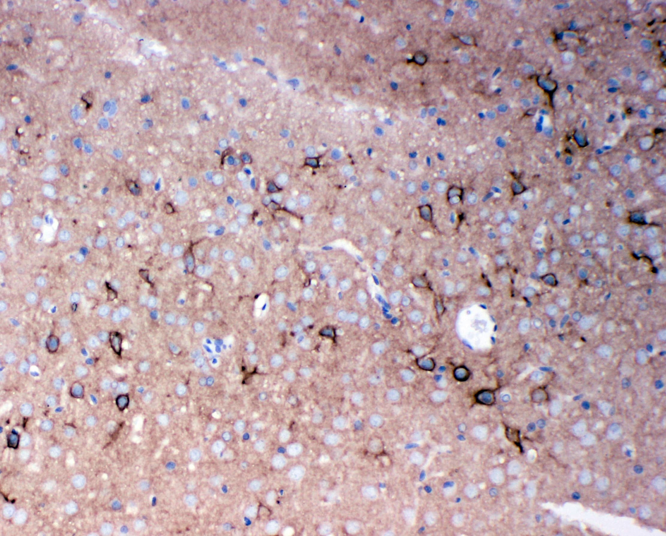 TNR / Tenascin R Antibody (aa104-117)