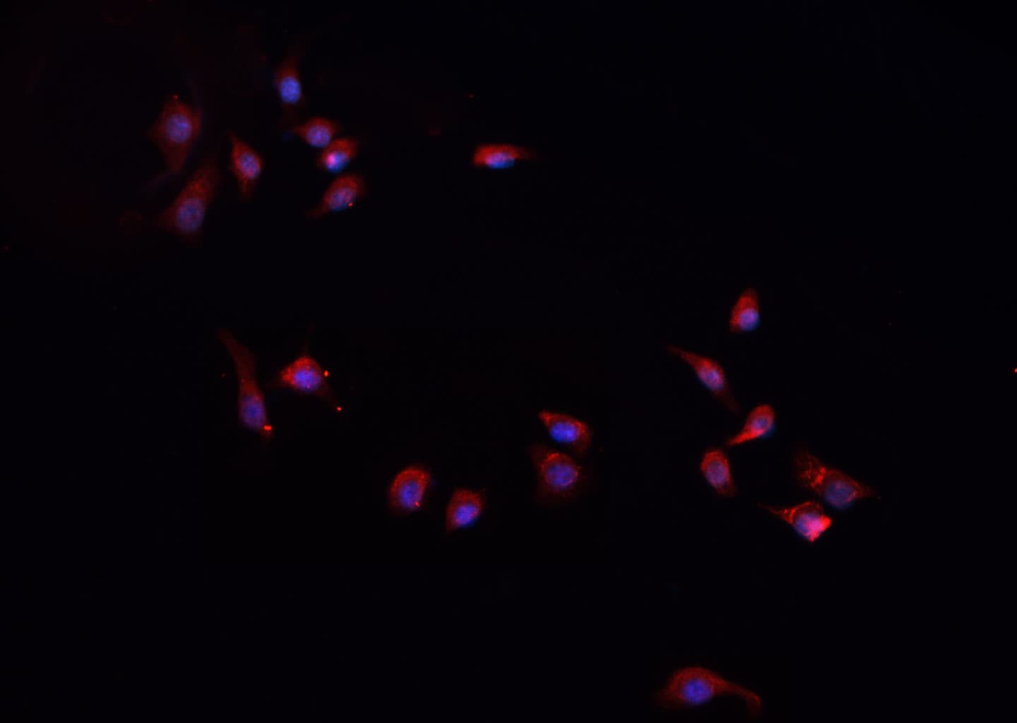 CXCL1 / GRO Alpha Antibody