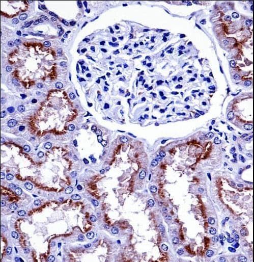 Polyclonal Rabbit anti-Human NOX4 Antibody (aa124-153, IHC, WB)