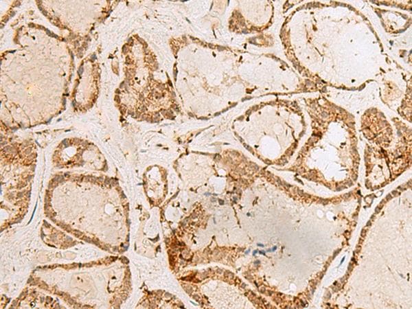 Polyclonal Rabbit anti-Human H3F3B Antibody (IHC)