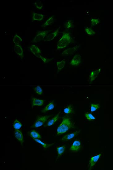 Tyrosinase Antibody