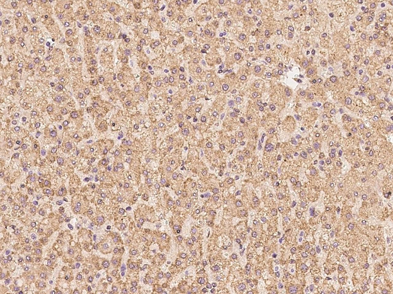 CLPX Antibody