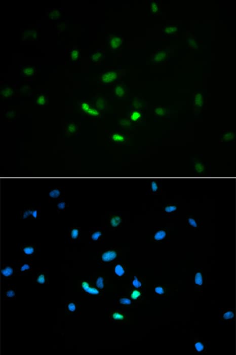 Polyclonal Rabbit anti-Human TP53 / p53 Antibody (IHC, IF, WB)