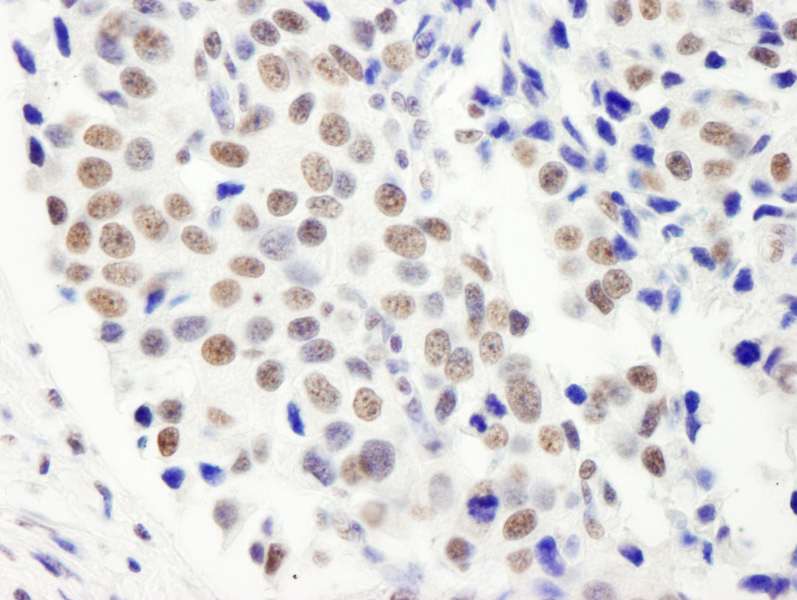 HFip1 / FIP1L1 Antibody (aa544-594)