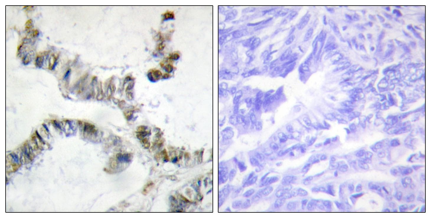 Polyclonal Rabbit anti-Human HMGXB3 / SMF Antibody (IHC)