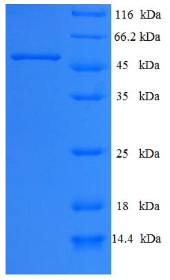 Human AASDHPPT / LYS5 Protein (Recombinant His-SUMO)