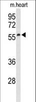 PA26 / SESN1 Antibody (aa14-43)