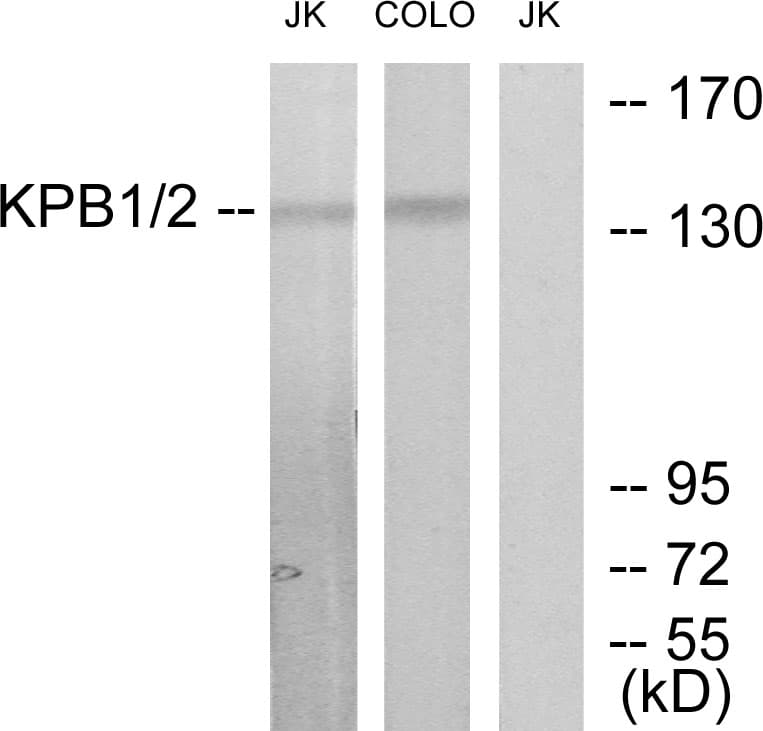 PHKA1 + PHKA2 Antibody (N-Terminus)