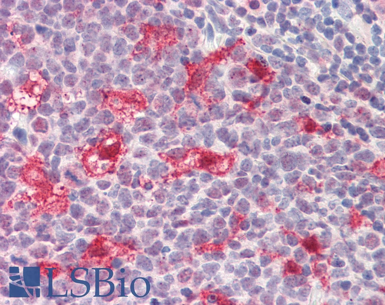 IHC-plus™ Polyclonal Goat anti-Human DNAJC5G Antibody (aa157-170, IHC)