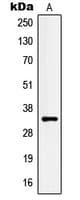 KLK3 / PSA Antibody (Internal)