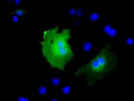 KBTBD7 Antibody (clone OTI1G3)