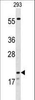 IHC-plus™ CLDN8 / Claudin 8 Antibody (aa140-166)