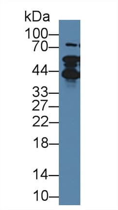 TMPO / TP / Thymopoietin Antibody (aa1-243, APC)