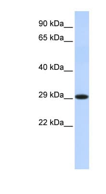 Polyclonal Rabbit anti-Human HSD17B14 Antibody (C-Terminus, WB)