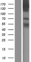 TBC1D9 Protein (Over-Expression Lysate Myc-DDK (Flag))