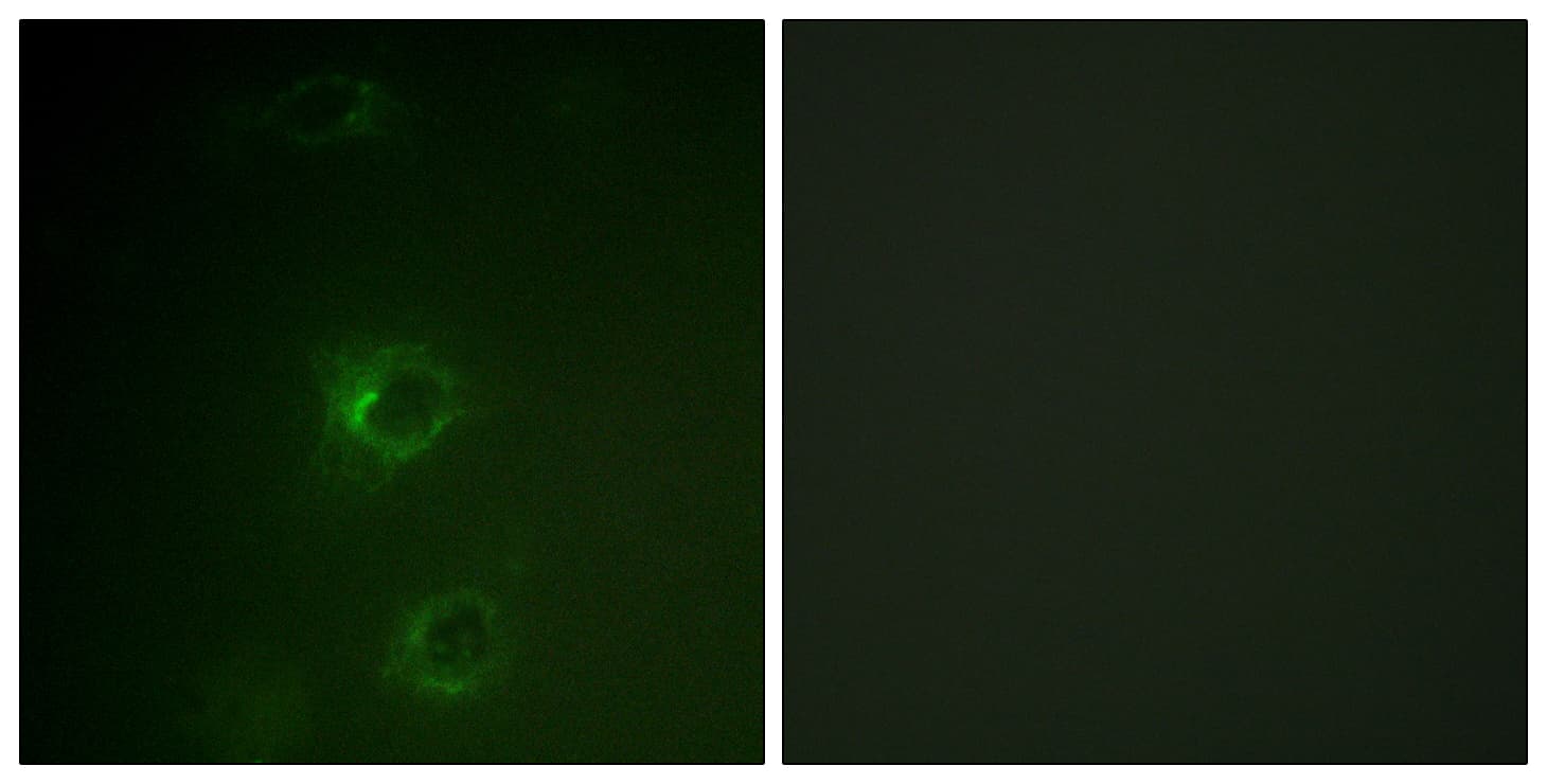 Polyclonal Rabbit anti-Human c-CBL Antibody (aa666-715, IHC, IF, WB)