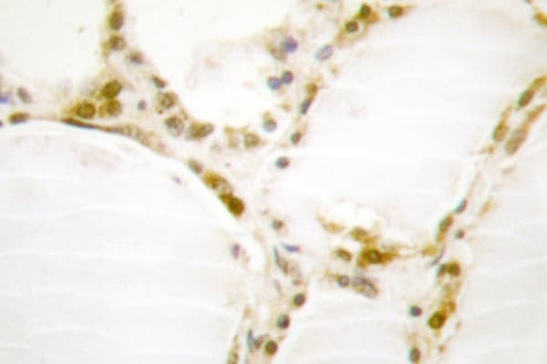 RB1 / Retinoblastoma / RB Antibody (Ser807)