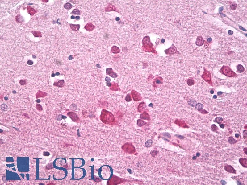 IHC-plus™ USP11 Antibody (Internal, clone EPR4346)