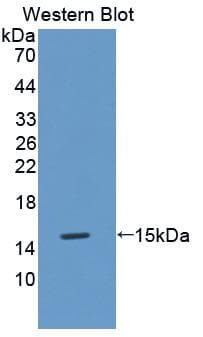 MT3 / Metallothionein 3 Antibody (aa1-68)