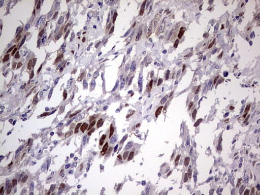 TNNT2 / CTNT Antibody (clone OTI3H2)