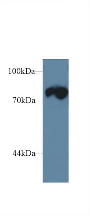 TRDN / Triadin Antibody
