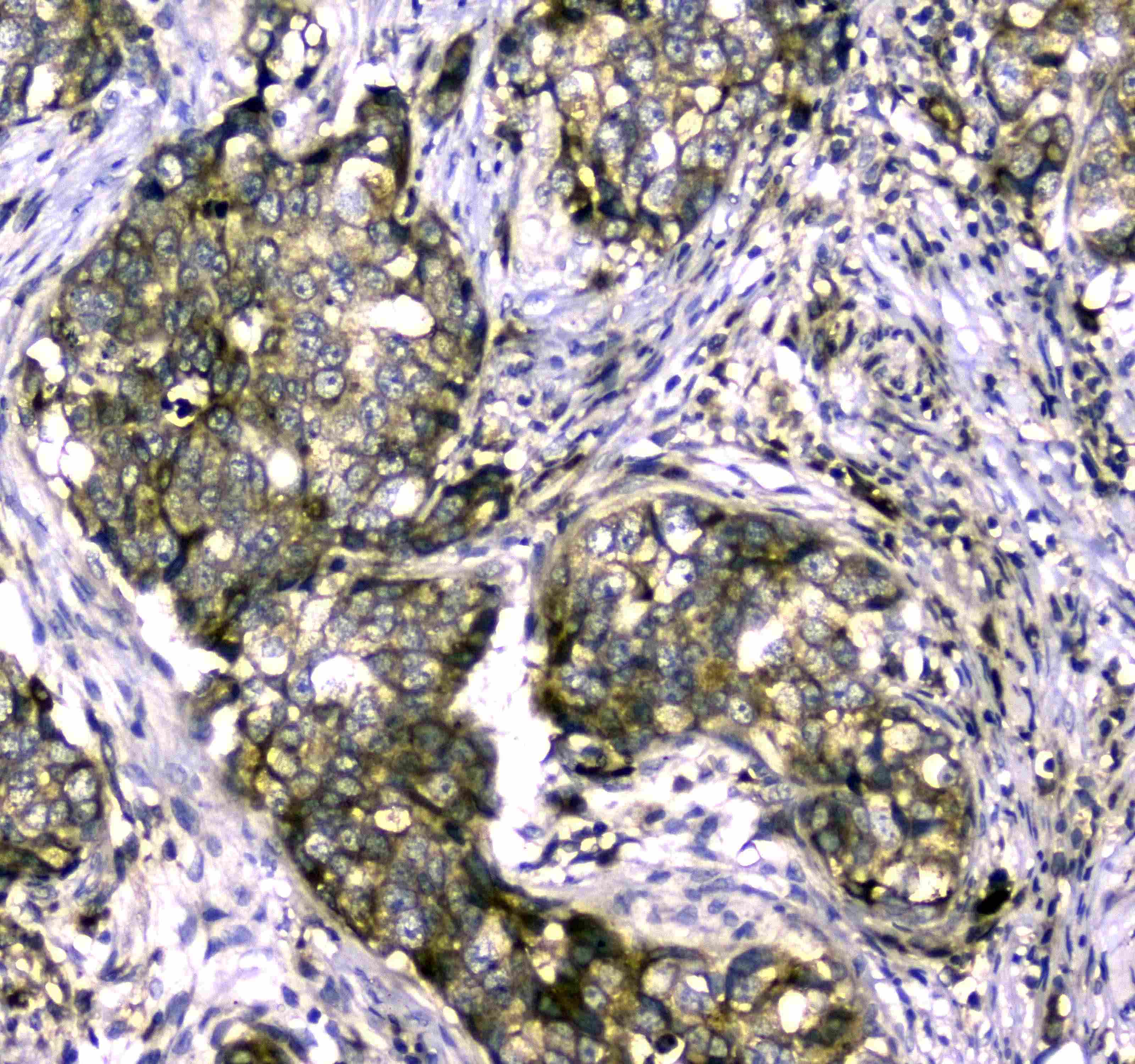 MYBPC3 / MYBP-C Antibody (aa1070-1123)