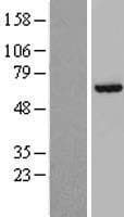 RSL1D1 Protein (Over-Expression Lysate Myc-DDK (Flag))
