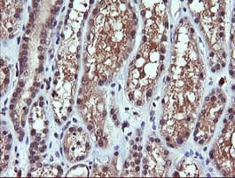 PIK3CG / PI3K Gamma Antibody (clone OTI6H5)
