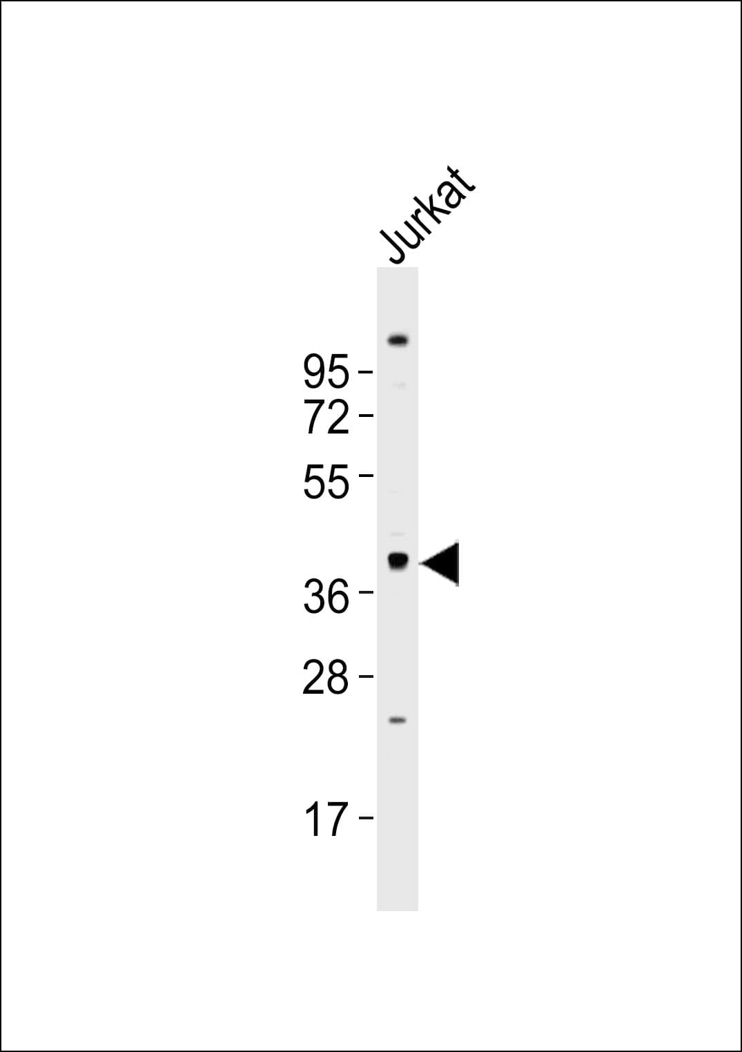 GPCRW / GPR18 Antibody