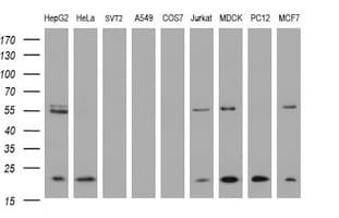 NDUFB9 Antibody (aa3-179, clone OTI4F8, Carrier-free)