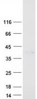 Human LIF Protein (Recombinant Myc-DDK (Flag))