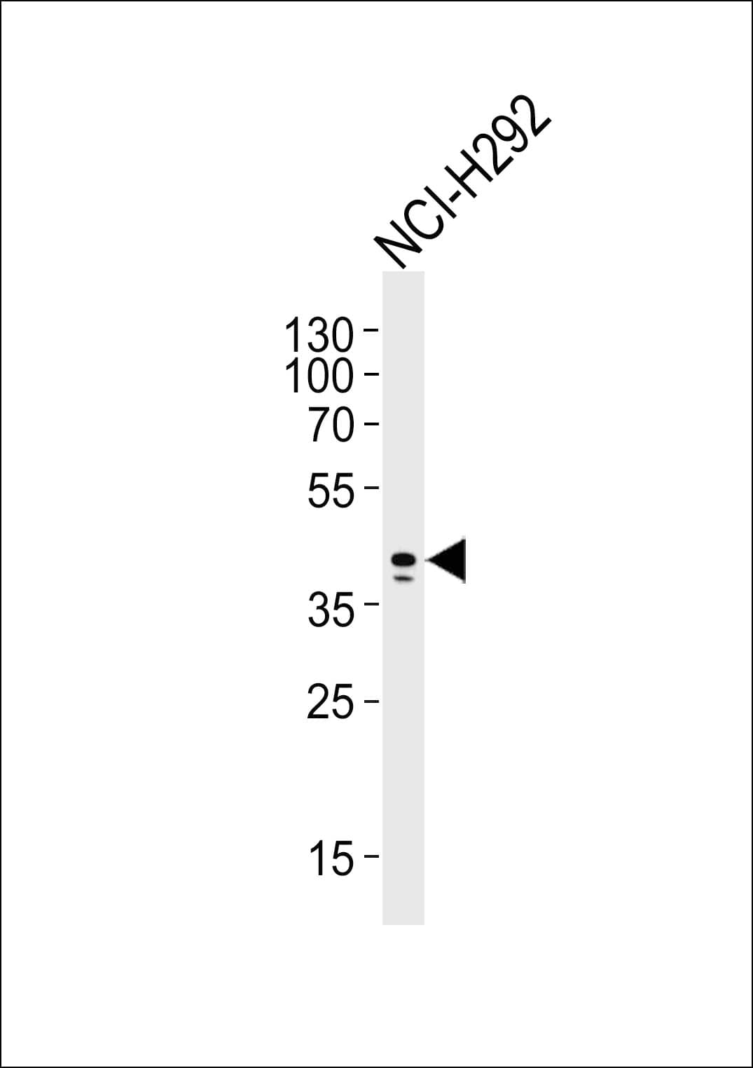 AIM2 Antibody (clone 812CT9.2.2.1)