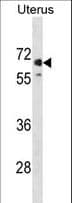 Polyclonal Rabbit anti-Human MMEL1 Antibody (aa50-78, WB)
