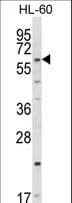 CYP51A1 / CYP51 Antibody (aa474-503)
