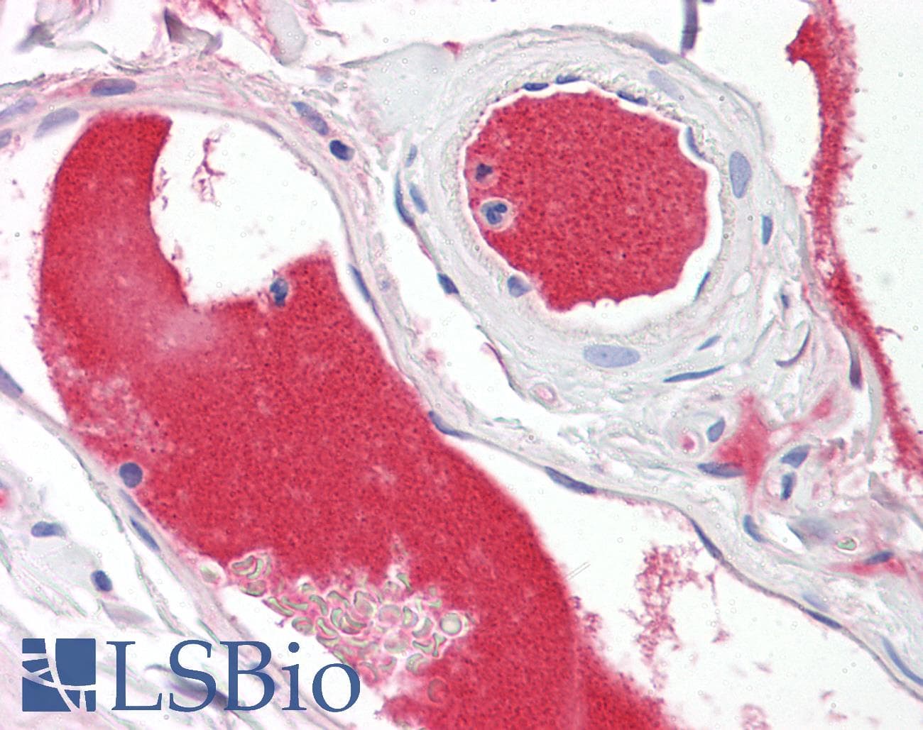 IHC-plus™ A1BG Antibody