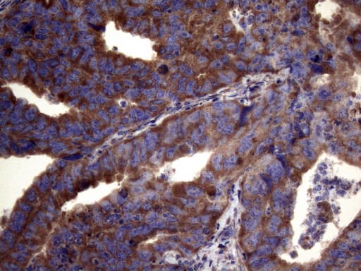 PAPSS2 Antibody (aa1-247, clone OTI6H10)
