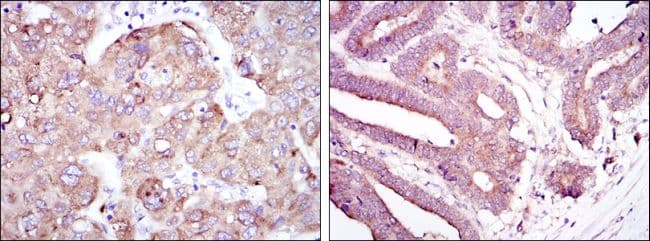 RBP4 Antibody (clone 4C2)
