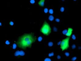 Monoclonal Mouse anti-Human MAPRE2 / EB2 Antibody (clone OTI7C10, IF, WB)
