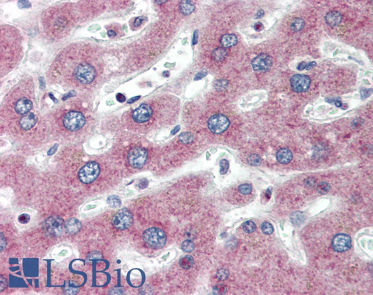 IHC-plus™ PTHR / PTHR1 Antibody (clone 3D1.1)