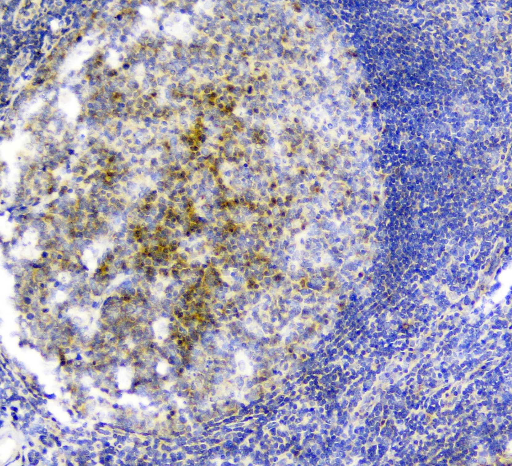 SNK / PLK2 Antibody