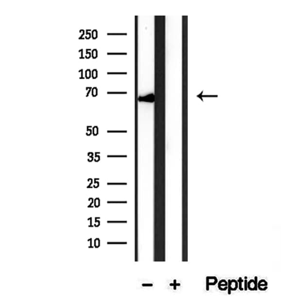SYVN1 / HRD1 Antibody