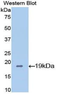PPIA / Cyclophilin A Antibody (aa2-164)