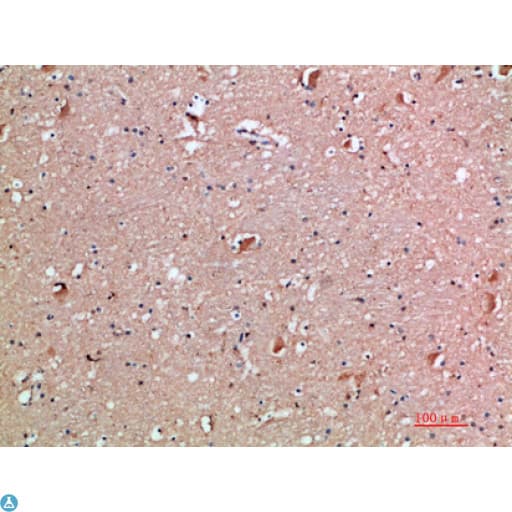 Polyclonal Rabbit anti-Human AcPL / IL18RAP Antibody (IHC)