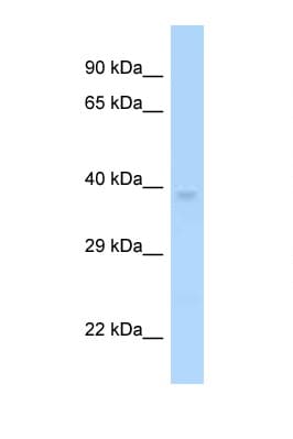 Polyclonal Rabbit anti-Human MAGEF1 Antibody (aa226-275, WB)