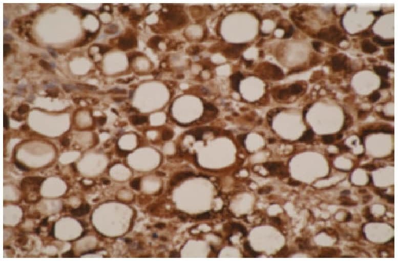 IHC-plus™ CYP26 / CYP26A1 Antibody (C-Terminus, clone F27 P6 A1)