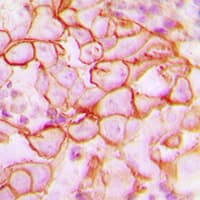ITGB3 / Integrin Beta 3 / CD61 Antibody (C-Terminus)