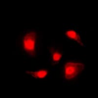 IHC-plus™ TP53 / p53 Antibody (phospho-Ser20)