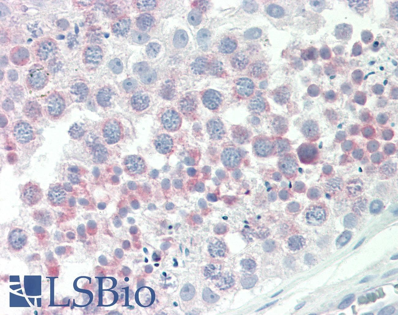 IHC-plus™ IGFBP1 Antibody (aa156-170)