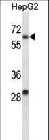 KCNC1 / Kv3.1 Antibody (aa479-508)